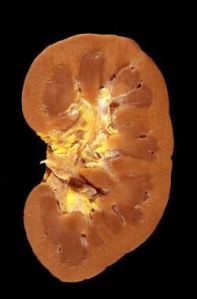 kidney