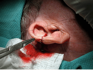 slightly gross, but representative.