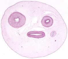 4e389e333932335bebd80e765a1ff6b3