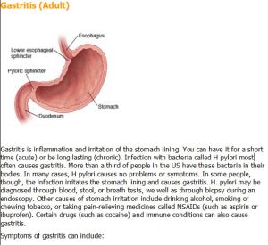 gastritis dc